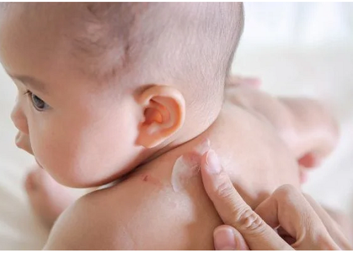 Sữa mẹ một trong nhiều cách đễ dưỡng ẩm da cho trẻ